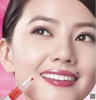 唇上痣6.jpg