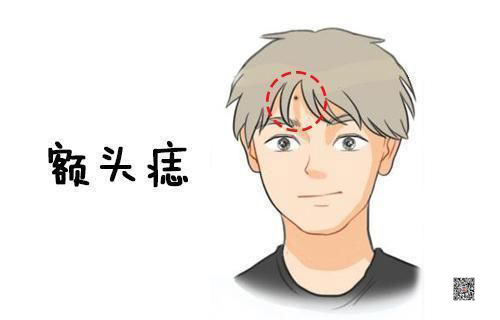 额头痣.jpg